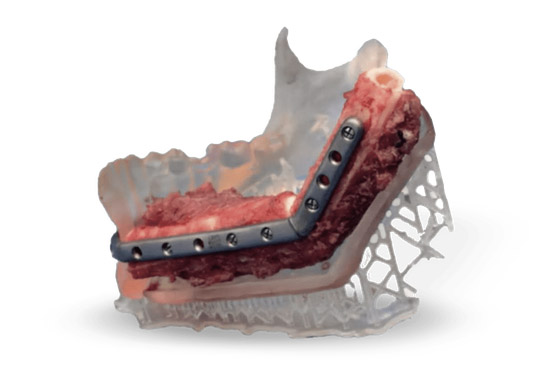 forschungsprojekt-form-3b Fomlabs Form 3B 3D-Druck
